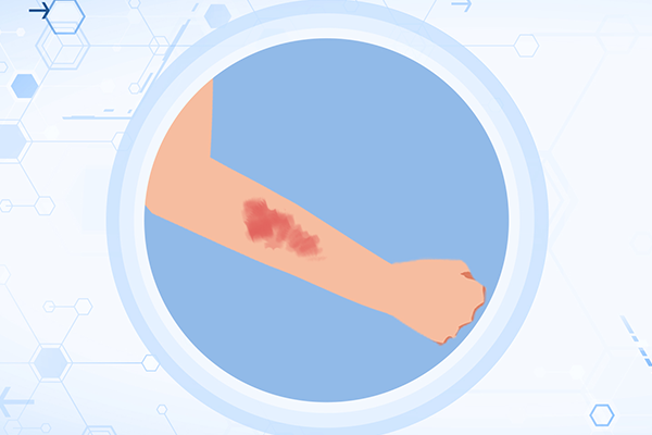 �˿����ϳ�ʲô�õÿ� ��ʲôʳ���˿����ϵĿ�